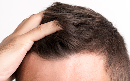 scalp